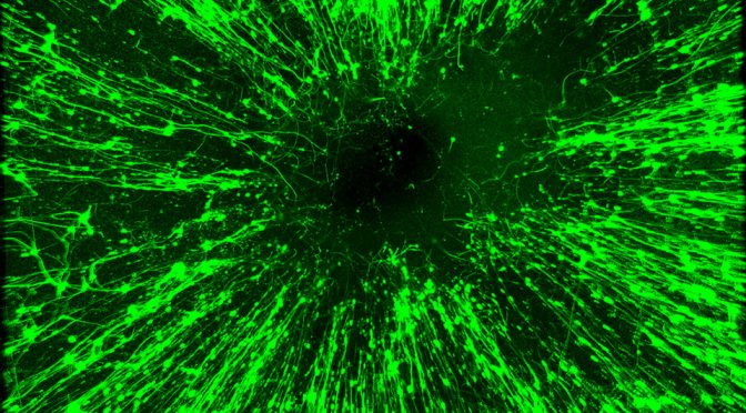 biomaterials in a retina
